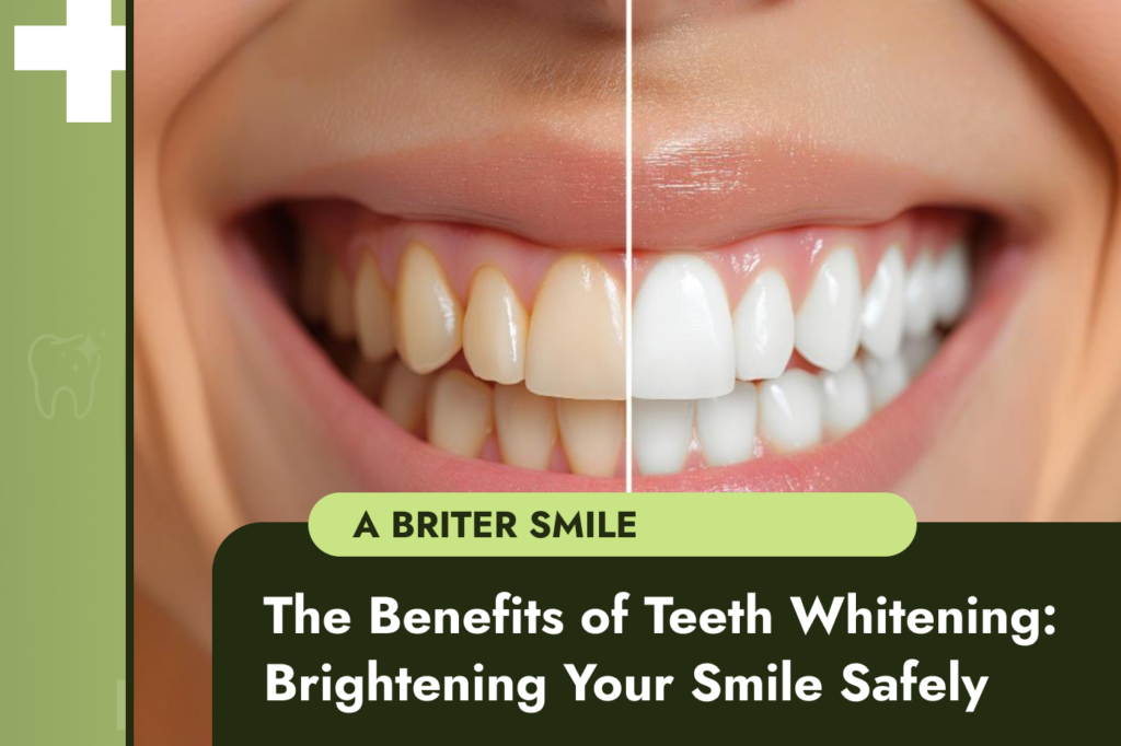 The Benefits of Teeth Whitening