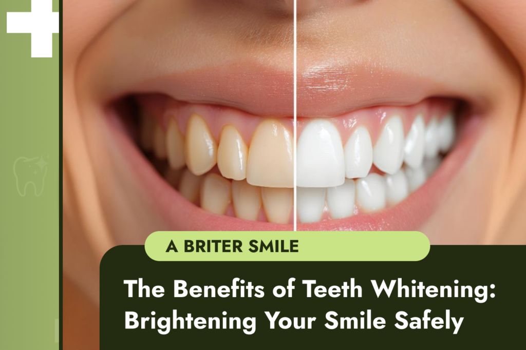 The Benefits of Teeth Whitening