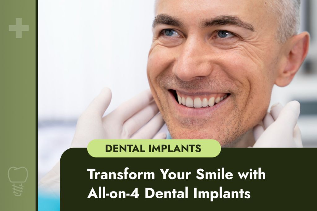 All-on-4 Dental Implants
