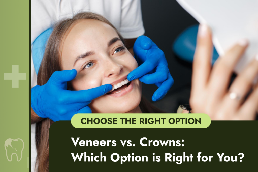 Veneers vs. Crowns