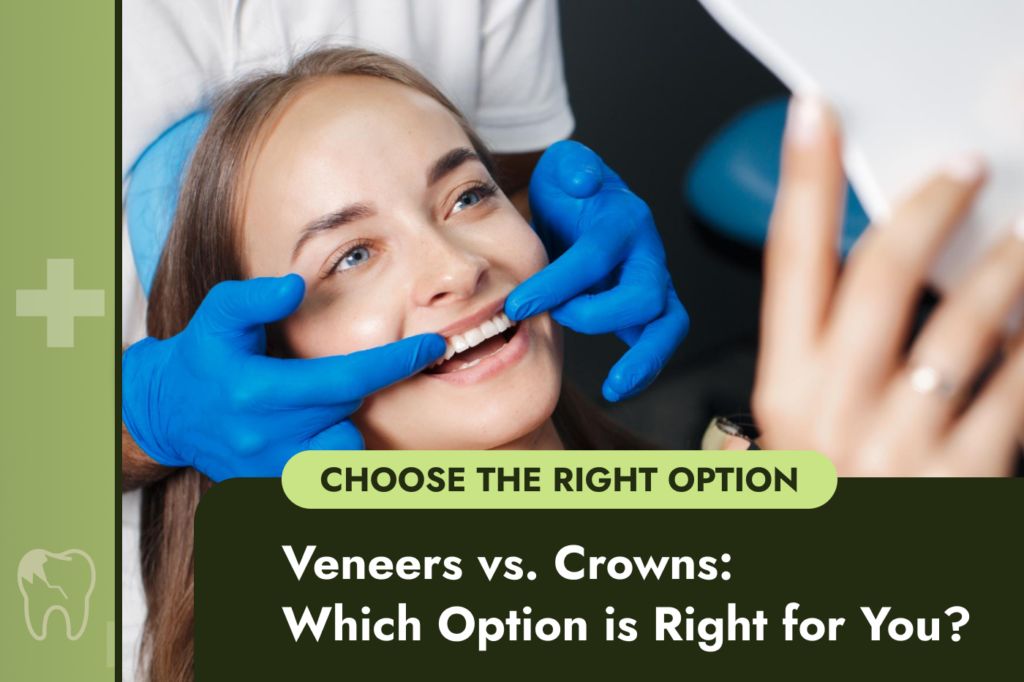Veneers vs. Crowns | Choose the best option