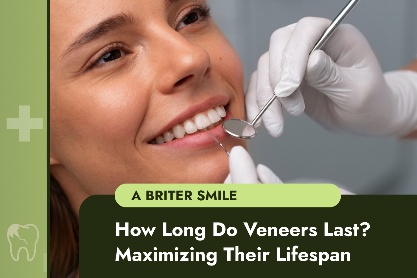 How Long Do Veneers Last? Tips for Maximizing Their Lifespan