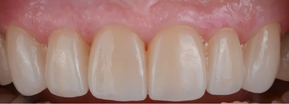 How to Choose a Family Dentist: What to Look For