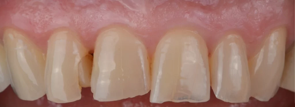 The Importance of Regular Dental Checkups: What to Expect at Your Visit